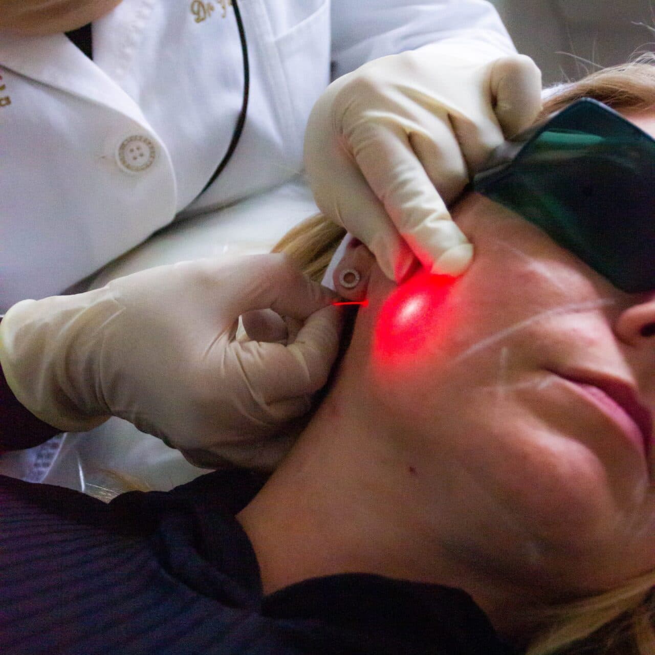 How Does Gym Training Complement Endolift® Treatments? Boost Results!