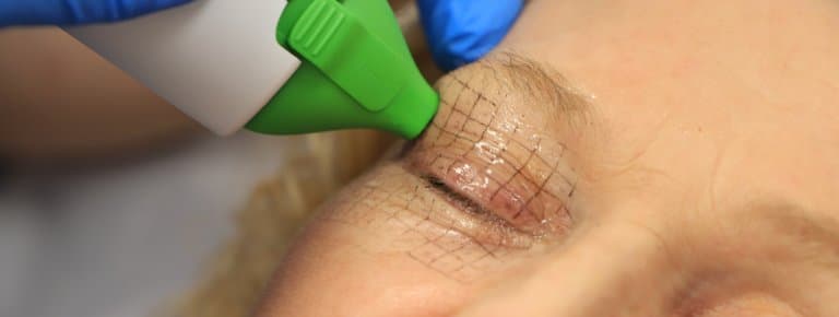 How Does Gym Training Complement Endolift® Treatments? Boost Results!